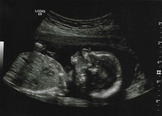 ultrasound 2016
